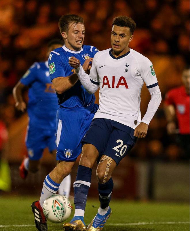 预期助攻 预期助攻